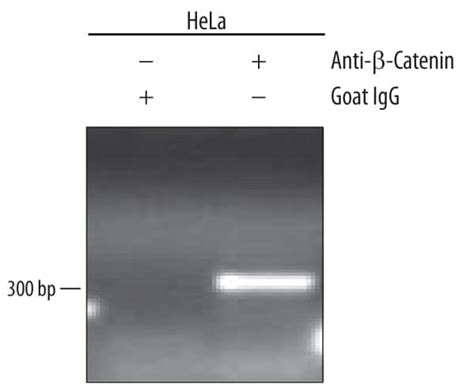 beta catenin antibody|Purified Mouse Anti.
